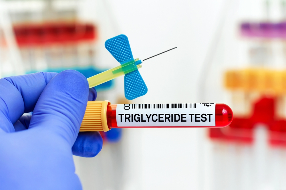 lower your triglyceride levels