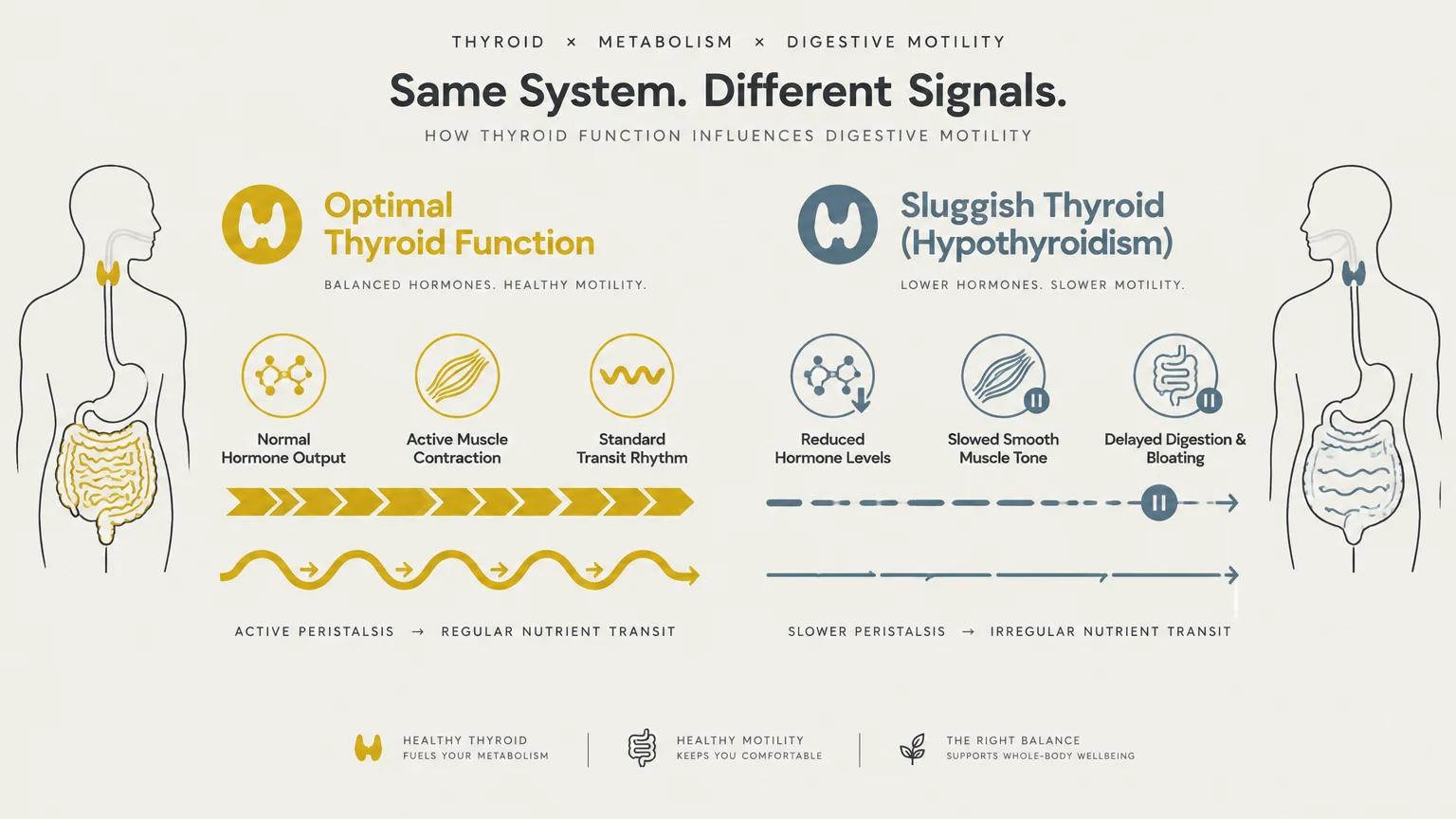 Diagram comparing optimal thyroid function and peristalsis with sluggish thyroid function, showing slowed motility.