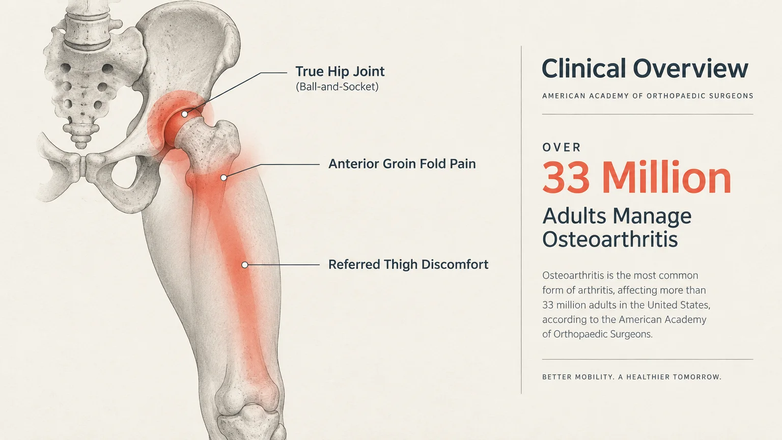 Medical diagram of hip and thigh bones highlighting pain radiating from the hip joint down the front of the leg.