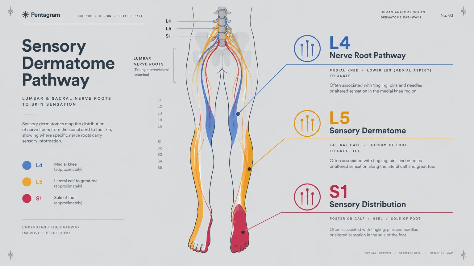 Medical diagram mapping L4, L5, and S1 sensory dermatome nerve pathways down the lower back, legs, and feet.